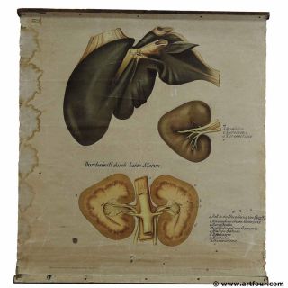 Old Antique Medical Wall Chart Anatomical Print Poster Kidney
