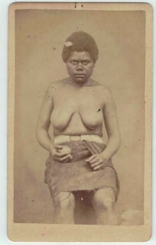 Caledonia Native Kanak Woman Topless Cdv C 1880,  Dufty Bros.  Pacific Islands