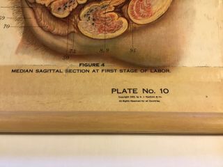 Antique NYSTROM 1922 Medical Human Anatomy Canvas Poster Charts Pull Down No.  10 10