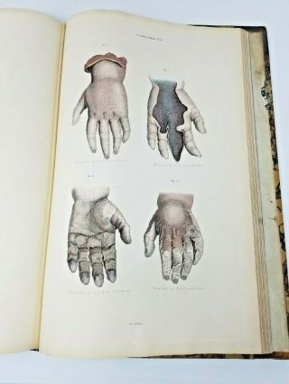 Beautifully Illustrated Lizars J - A System Of Anatomical Plates Of The Human Body