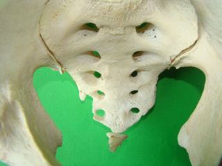 ANTIQUE SCIENTIFIC MEDICAL PELVIS ANATOMICAL MODEL 2