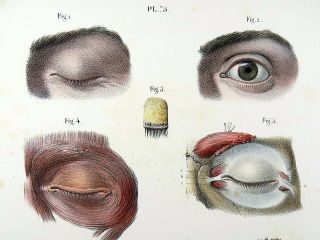 1853 Hirschfeld Anatomy Optics Hand Colour Masterpiece Medical Illustration