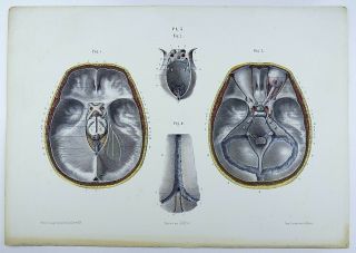 1853 Hirschfeld ANATOMY SKULL hand colour MASTERPIECE MEDICAL ILLUSTRATION 2