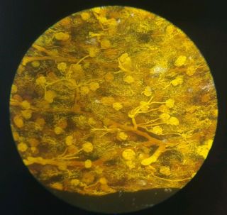 Fine Antique Microscope Slide " Kidney Of Giraffe " By ?topping