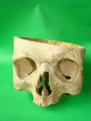 ANTIQUE SCIENTIFIC MEDICAL SKULL ANATOMICAL MODEL 10