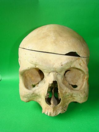 Antique Scientific Medical Skull Anatomical Model