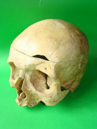 ANTIQUE SCIENTIFIC MEDICAL SKULL ANATOMICAL MODEL 3