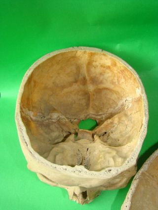 ANTIQUE SCIENTIFIC MEDICAL SKULL ANATOMICAL MODEL 6