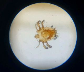 Fine Antique Microscope Slide " Human Crab Louse