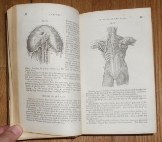 1866 Antique Book Compendium of the Various Branches of Medical Science Surgery 4