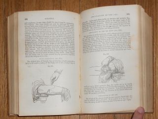 1866 Antique Book Compendium of the Various Branches of Medical Science Surgery 5