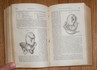 1866 Antique Book Compendium of the Various Branches of Medical Science Surgery 6