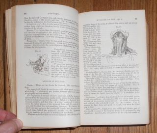 1866 Antique Book Compendium of the Various Branches of Medical Science Surgery 8