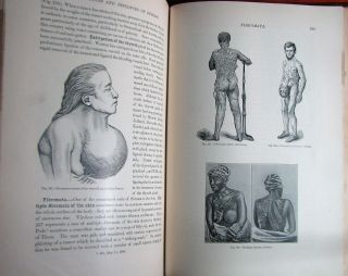 Rare Early Medical Monsters & Freaks / Human Oddities Cases Illustrated Book