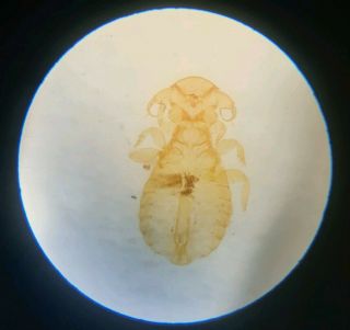 Fine Antique Microscope Slide " Parasite Of Golden Eagle " By Henry E.  Freeman