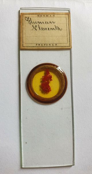 Very Fine Antique Microscope Slide " Human Placenta " By J.  T.  Norman
