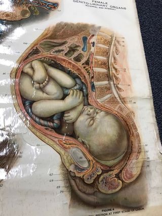 Antique NYSTROM 1922 Medical Human Anatomy Canvas Poster Pull Down Chart PENIS 6