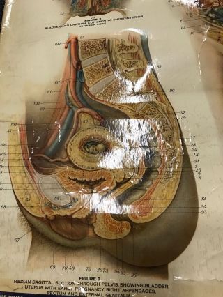 Antique NYSTROM 1922 Medical Human Anatomy Canvas Poster Pull Down Chart PENIS 8