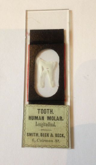 Antique Microscope Slide Molar Human Dentist Dentistry Rare Old Long.  Sect