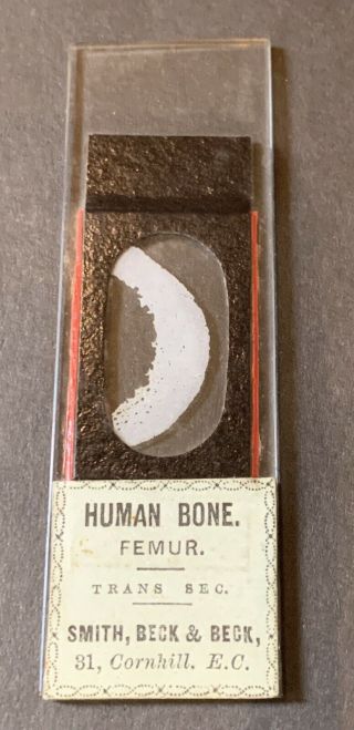Antique Victorian Microscope Slide Rare Human Bone Femur T.  S Thin Section Old