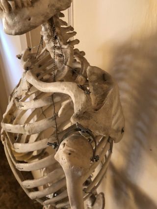 Authentic Antique Medical Teaching Skeleton 10