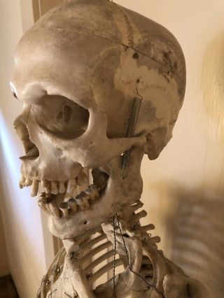 Authentic Antique Medical Teaching Skeleton 2