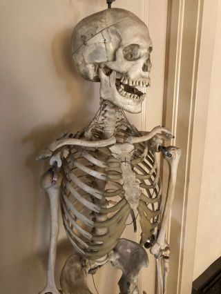 Authentic Antique Medical Teaching Skeleton 3