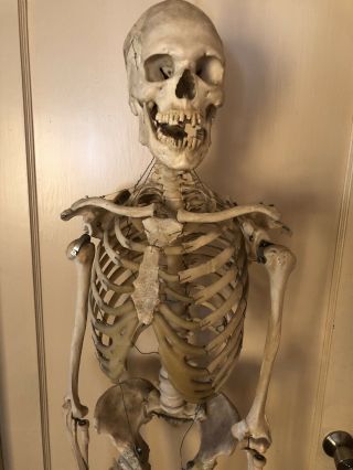 Authentic Antique Medical Teaching Skeleton 4