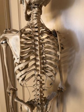 Authentic Antique Medical Teaching Skeleton 5