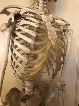 Authentic Antique Medical Teaching Skeleton 6