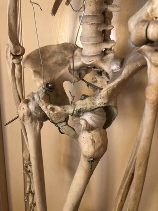Authentic Antique Medical Teaching Skeleton 7