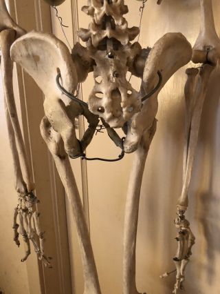 Authentic Antique Medical Teaching Skeleton 9