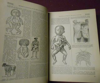 Rare 1889 Color Illustrated Medical Book Siamese Twins Trephining Diseases