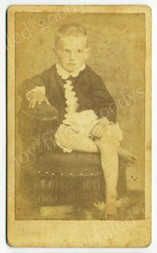 Barefoot Confederate Southern Boy Petersburg Virginia Civil War Era Cdv