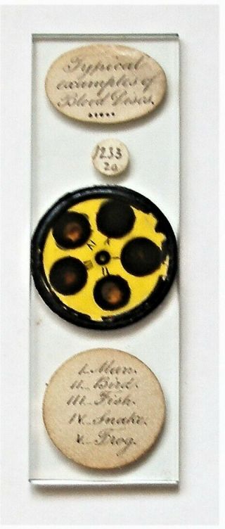 Antique Microscope Slide By Watson Of Multispecimens Of Blood Discs