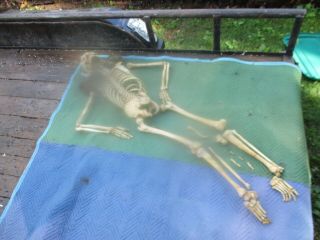 Old Brass Mounted Medical Skeleton