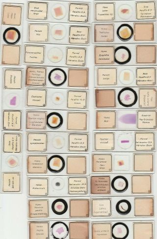 A Cased Selection Of 25 Human Histology Microscope Slides By J.  D.  Möller
