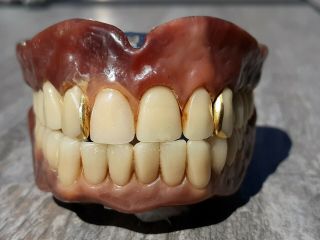 Vintage Authentic Dentures False Fake Teeth 2 Gold Fillings Silver Lining?
