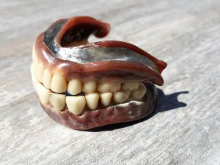 Vintage Authentic Dentures False Fake Teeth 2 Gold Fillings silver lining? 3