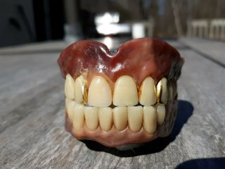 Vintage Authentic Dentures False Fake Teeth 2 Gold Fillings silver lining? 5