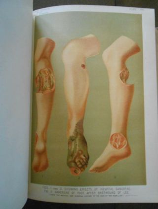 Rare Antique Color Illustrated Medical Book Over 100 Years Gangrene Diseases