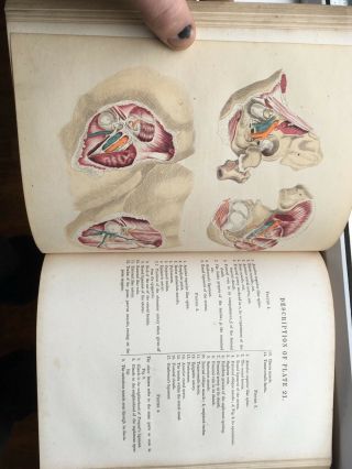 Rare Victorian Medical Book Maclises Surgical Anatomy 1857 with 36 Colour Plates 5