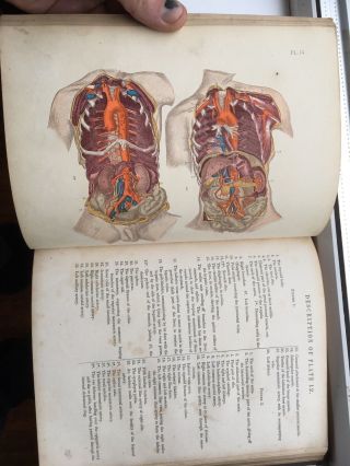 Rare Victorian Medical Book Maclises Surgical Anatomy 1857 with 36 Colour Plates 6