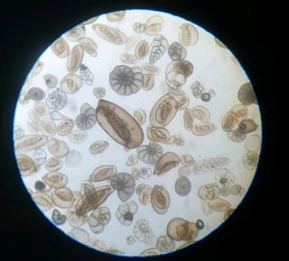 Antique Microscope Slide Foraminifera From Mediterranean No.  9