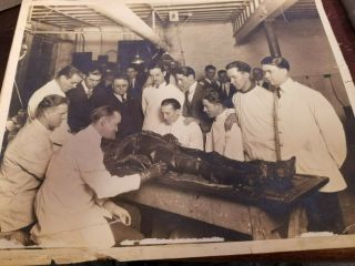 Vintage Autopsy Photograph - 1925 Kansas City Dental College - Cadaver
