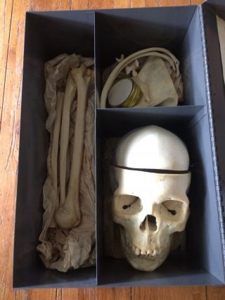 Real Human Skull Medical Dental Teaching Training Vintage Rare Heavy Old Patina