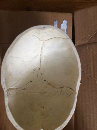 REAL Human Skull Medical Dental Teaching Training Vintage rare heavy Old Patina 7