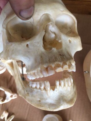 REAL Human Skull Medical Dental Teaching Training Vintage rare heavy Old Patina 8
