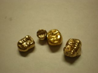 11 Grams Solid Gold Antique Dental Tooth Crown Scrap Gold Teeth