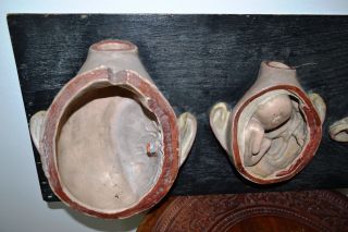 Antique Plaster/Papier Mâché Section Anatomical Model.  Womb with the fetus.  1930s 3